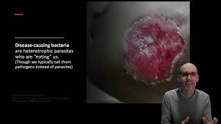 How do bacteria cause disease [upl. by Zennie813]