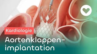 TAVI TranskatheterAortenklappenimplantation  Hightech in der Medizin [upl. by Stern]