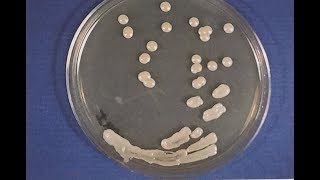 Cryptococcosis  Opportunistic Mycoses 1 S0125 Microbiology MCQs [upl. by Eelirem]