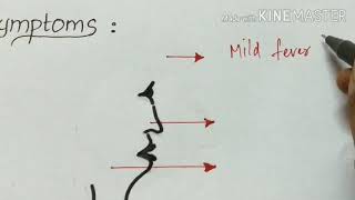 bordetella pertussis  microbiology [upl. by Hallagan]