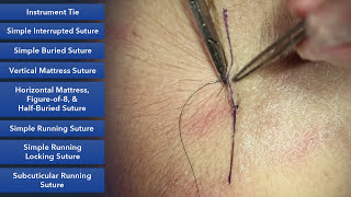 Learn How To Suture  Best Suture Techniques and Training [upl. by Shayn539]