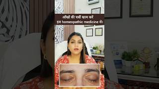 आखों पर जमा फैट हटाए आसानी से  Xanthelasma Treatment Easy And Simple Treatment [upl. by Mauri]