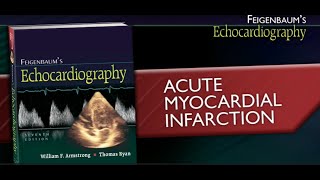 Acute Myocardial Infarction by Feigenbaums Echocardiography [upl. by Barren]