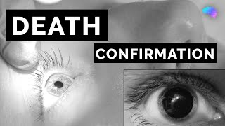 Death Confirmation  How to Confirm Death  OSCE Guide  UKMLA  CPSA [upl. by Bello]