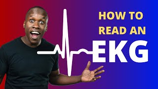 How to Read an EKG Made Easy [upl. by Axel]