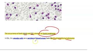 Chronic lymphocytic leukemiaCLL [upl. by Nett]