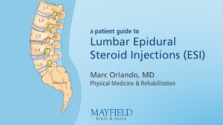 Lumbar Epidural Steroid Injections [upl. by Erodasi623]