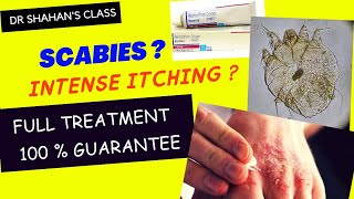 Scabies Treatment  100  sure treatment scabies treatmentplan dermatology [upl. by Aiciled]