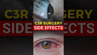 C3R Surgery Side Effects [upl. by Fromma]