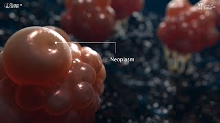 Neoplasm  3D Animation [upl. by Drisko]