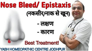 Nose bleed in child  epistaxis  नकसीर । नाक से खून । Best homeopathic treatment [upl. by Erasme]