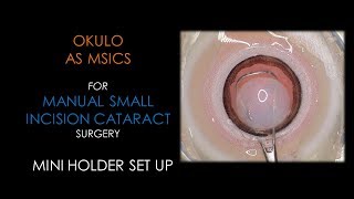 BIONIKO OKULO MSICS  Manual Small Incision Cataract Surgery [upl. by Ericha175]