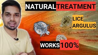 How to Remove Parasites from Goldfish  ArgulusLice  Natural Technique  No Chemical  Best Way [upl. by Ttreve]