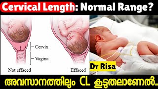 നേരത്തെയുള്ള പ്രസവ സാധ്യതക്ക് കാരണമാകുന്ന CERVICAL LENGTH 9 month Pregnancy [upl. by Aydne]