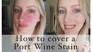 How to cover a Port Wine Stain birthmark [upl. by Atnuahsal]