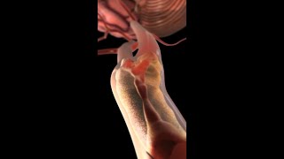 Carotid Arteries Under Attack How Plaque Leads to Stroke medicine anatomy shorts [upl. by Seaden]