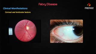 Fabrys disease [upl. by Maze]