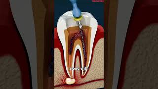 What Is A Root Canal 😳facts shorts youtubeshortsshortsvideo reels [upl. by Sebbie]