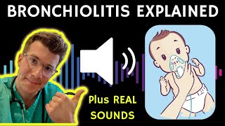 Doctor explains Bronchiolitis RSV with example of REAL SOUNDS  Respiratory syncytial virus [upl. by Seiter]