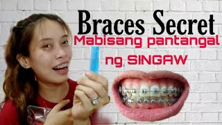 Braces SECRETmabisang pantangal ng SINGAW Braces Journey [upl. by Eceirahs104]