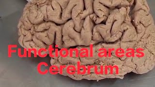 Functional areas of brain neuroanatomy cerebrum anatomy functional areas of cerebrum [upl. by Miarzim]