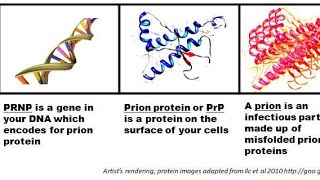 Prions  Prions Disease  Transmissible Spongiform Encephalopathies Diagnosis and treatment [upl. by Minni]