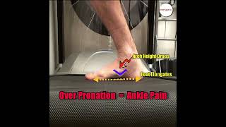 Over pronation can cause foot and ankle pain [upl. by Jeni]