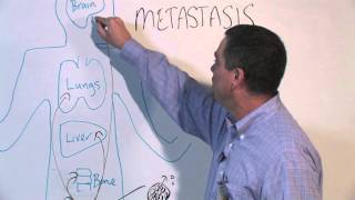 How Cancer Spreads Metastasis  Michael Henry PhD [upl. by Peatroy]