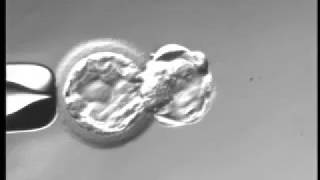 Day 5 full hatched blastocyst under microscope [upl. by Sharos]