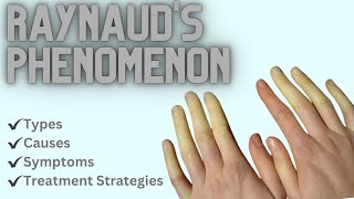 Raynauds Phenomenon Types Causes Symptoms and Treatment Strategies [upl. by Tzong]