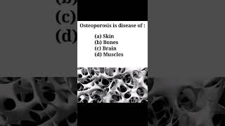 quotOsteoporosisquot Mdcat preparing for mcqs of biology biology mdcat [upl. by Tija602]