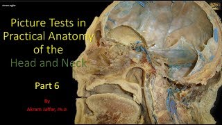 Picture tests in head and neck anatomy 6 [upl. by Aleece]