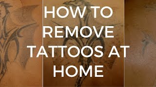 How To Remove Tattoos at Home Using a TCA Peel [upl. by Schlicher]