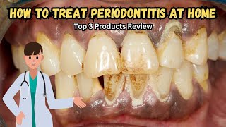 🦷 How to Treat Periodontitis at Home 🏡  Effective Products amp Tips [upl. by Brande563]