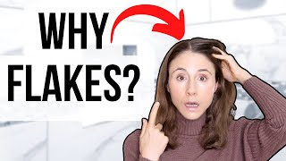 Why Your Scalp Is Flaky The Difference Between Dryness And Dandruff Explained [upl. by Kelsi]