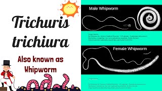 Whipworm Simplified Guide to Trichuris trichiura Trichuriasis and Intestinal Nematodes [upl. by Anaoj476]