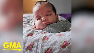 Baby girl born with rare 4pound tumor [upl. by Andeee]