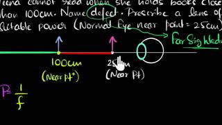 Numerical on hypermetropia [upl. by Anaiuq]