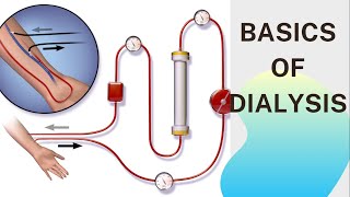 Basic concept of Dialysis Machine  Fresenius 4008S  Dialyzer amp Dialysate Function [upl. by Yttiy679]