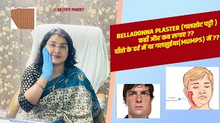 Belladonna plaster गलसोट पट्टी कहाँ और कब लगाए  दाँतो के दर्द में या गलसुईयाMumps में [upl. by Enomal]