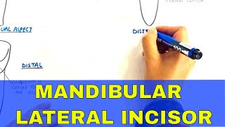 Anatomy of Mandibular Lateral Incisor  Tooth Morphology [upl. by Atter]