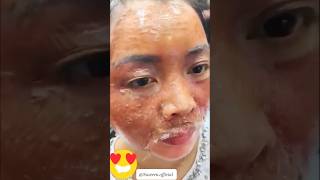 Get Spotless amp Glowing Skin  Remove Dark Spots amp Pigmentation In 7days beautiful shorts viral [upl. by Nowtna]