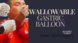 Swallowable Elipse Gastric Balloon A Simple Weight Loss Solution Istanbul swallowablegastricballon [upl. by Airehtfele]