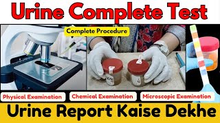 Urine Examination Test  Urine Test Report Kaise dekhe  Microscopic Examination of Urine urinary [upl. by Trillbee99]