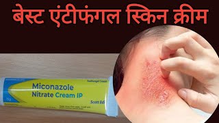 Miconazole Antifungal creamMicogel Antifungal cream Miconazole Nitrate CreamuseApplyside effect [upl. by Norbert]