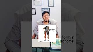 Piriformis Syndrome pain  Dr Akram  thai ka dardpiriformissyndromepiriformis painphysiotherapy [upl. by Kassi263]