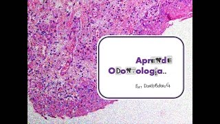 Lesiones de la mucosa  Patología oral [upl. by Ainocal806]