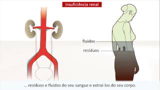 Doença renal  Causas e tratamento [upl. by Perren202]