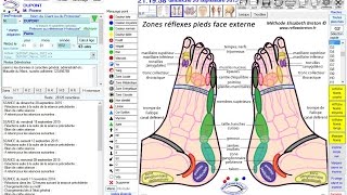 ReflexoVISU logiciel de Reflexologie et approches complémentaires [upl. by Stanwinn]