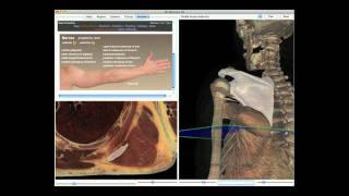 Cadaver Dissection Guide Overview [upl. by Lehctim]